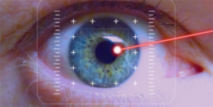 laser